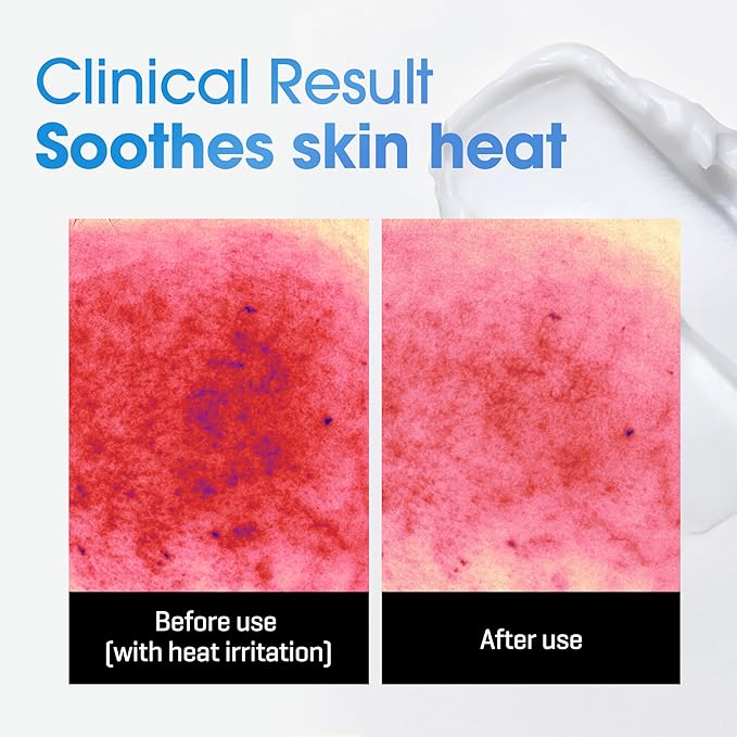 SOME BY MI AHA BHA PHA 30 Days Miracle Acne Clear Body Cleanser & Beta-Panthenol Repair Body Cream
