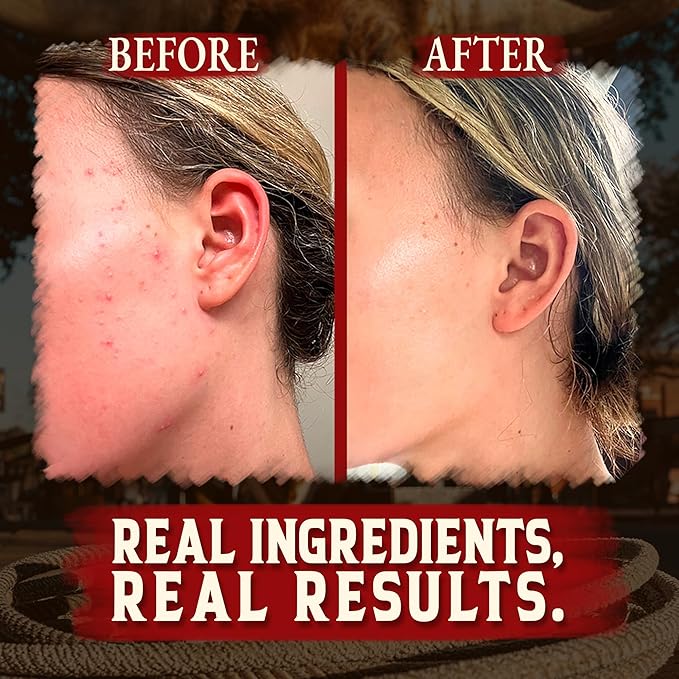 Organic Beef Tallow for Skin - 4 OZ (Unscented) — US-Made Grass Fed Beef Tallow for Face + Body — Whipped Tallow and Honey Balm Moisturizer for Dry and Sensitive Skin, Eczema, Rosacea (No Additives)
