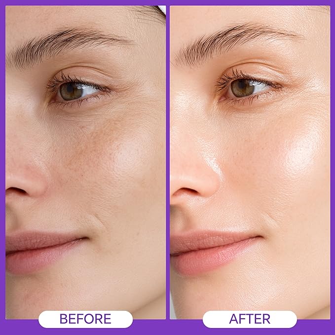 Hydrating Hyaluronic Acid Serum with 3 Ceramides, Vitamin B5 & Niacinamide - Paraben-Free, Replenishes Hydration for Smoother, Softer Skin - 1 Fl Oz (30ml)