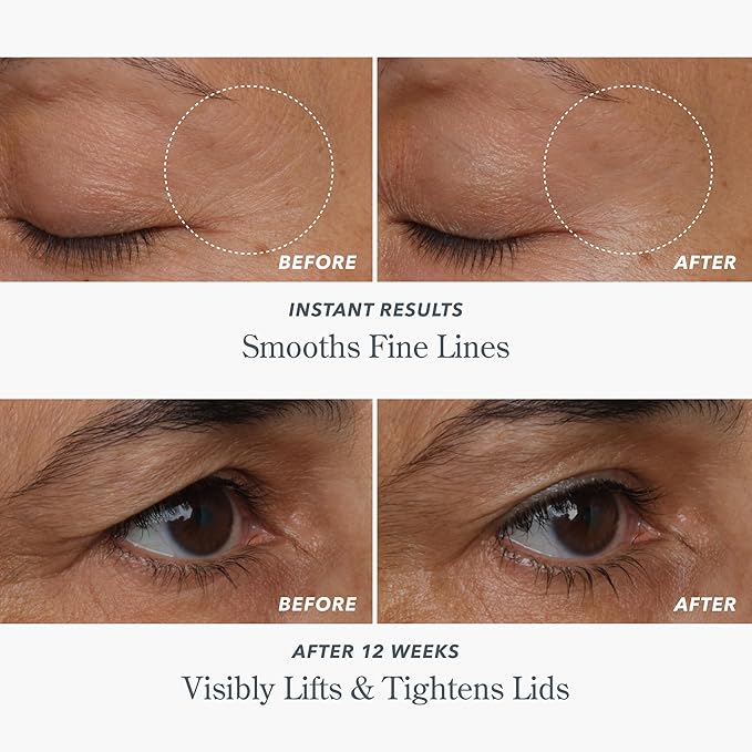 Beekman 1802 Milk RX Advanced Better Aging Dual Eye Treatments – Under Eye Wrinkle Cream & Eyelid Lift Serum with Peptides & Goat Milk Exosomes, Retinol Alternative