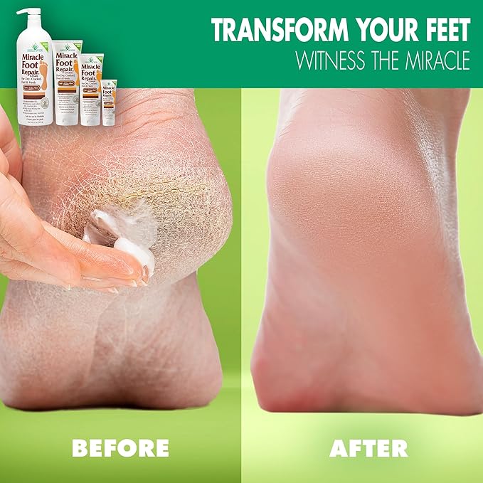 Aloe Vera Lotion & Foot Cream Combo – Aloe All Over 1 oz + Foot Repair 4 oz – Soothing Aloe Lotion for Dry Skin, Hands, Heels & Body – Diabetic-Safe Foot Cream for Cracked Feet