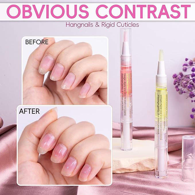 2PCS Cuticle Oil Pen for Nails,Nail Oil Pen for Nail Care,Cuticle Oil for Nails with Nail File,Nail Oil Cuticle Prevent Dry Cracking and Hangnails,Deep Nourishment(Pineapple & Peach Flavor)