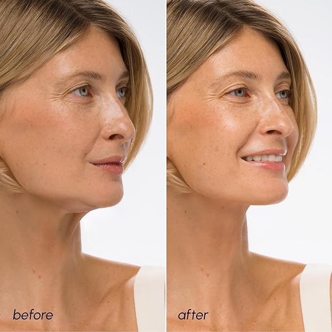MAREE V Line Lifting Mask with Hyaluronic Acid – Deep Collagen Face Mask for Women – Jawline Shaper Facial Masks with Retinol – Tightening & Firming Neck Lift Tape – Double Chin Strap for Face Lift