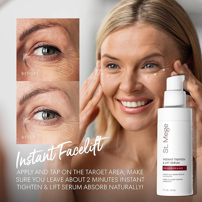 Instant Eye & Face Lift Cream: Rapid Under Eye Bags Wrinkle Smile Lines Forehead Lines Remover - Temporary Firming & Tightening Treatment in 2 Minutes, 1 fl. oz.