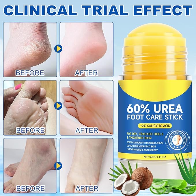 60% Urea Foot Cream for Cracked Heels, Maximum Strength 2% Salicylic Acid, Fast Absorbing, Intensive Moisturizing Foot Repair for Dry, Rough Skin & Callus Remover for Feet, 1.41 Oz