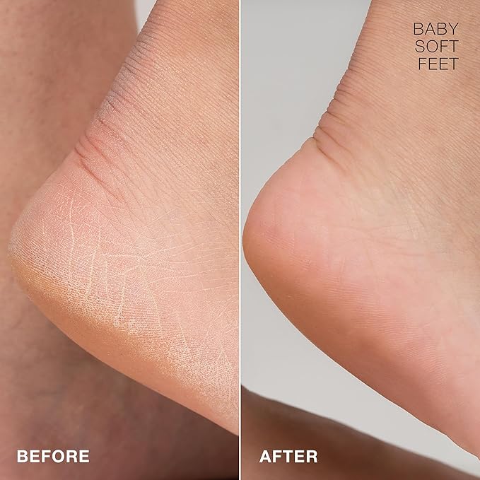 STARSKIN Magic Hour, Exfoliating Foot Mask Sock with Lactic and Glycolic Acid, Gently Removes Calluses and Dead Skin for Effective Peeling, K Beauty Skincare (4 Pack)