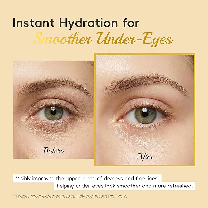 5 Pairs Snail Collagen Eye Mask, Under Eye Patches Collagen Pads with Peptides & Hyaluronic Acid, Hydrating & Smoothing, Reduces Puffiness Dark Circles & Fine Lines, Radiance Skin