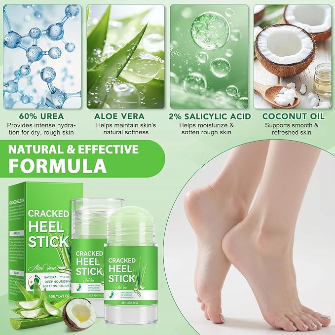 Cracked Heel Urea Stick,Aloe vera Scent,Foot Care Cream 60 Percent Stick,Maximum Strength Urea Cream for Feet,Moisturizer and Hydrates Dry Cracked Feet, Knees, Elbows, Hands