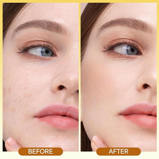 Skin Renewing Vitamin C Serum 30ml - Pure Vitamin C Serum Dermatologist Developed Brightening Antioxidant Face Serum for Glowing Skin,Hydrating Skin Barrier Repair Serum.