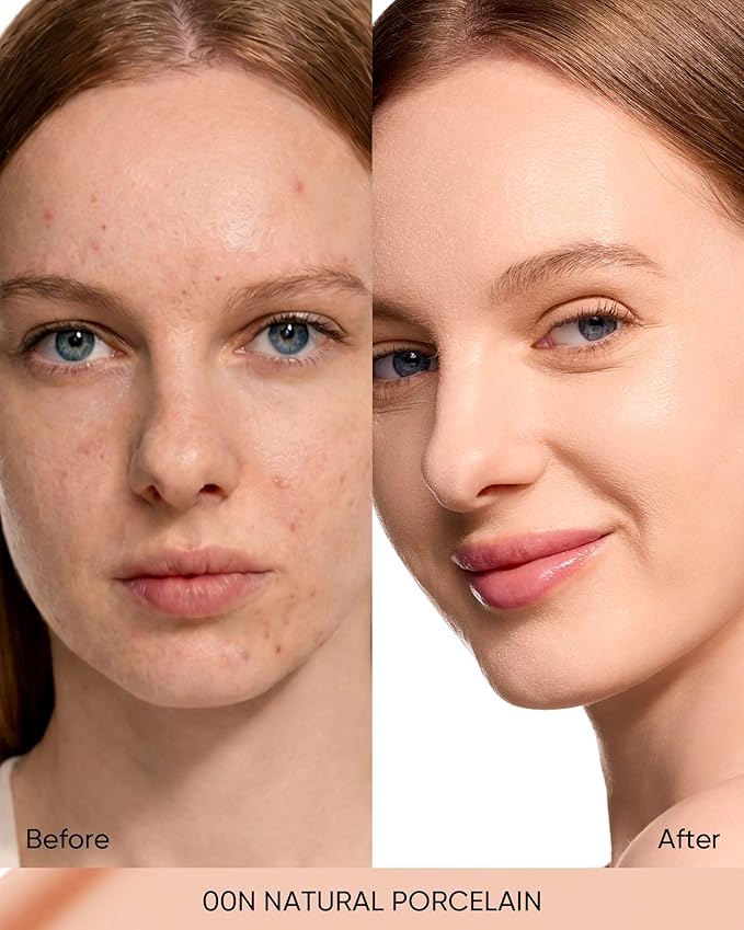 SKINTIFIC Full Coverage Cushion Foundation #00N Natural Porcelain| Satin Glow Finish, Oil-Control & Waterproof, Buildable Tattoo Cover Cushion for All Skin Types