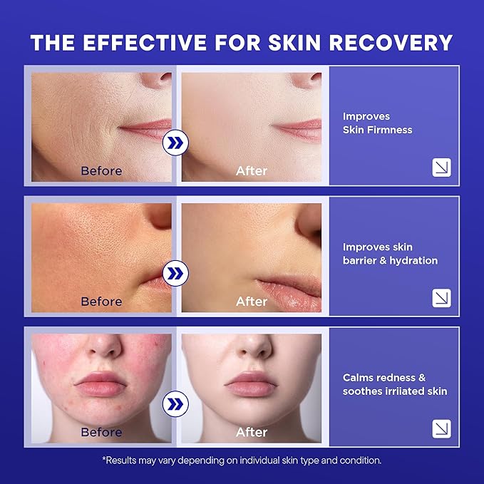 Lanmeri Copper Peptide Serum for Face: 1% Copper Peptide (GHK-Cu) Anti-Aging Serum to Smooth Fine Lines, Improve Elasticity & Boost Collagen - Soothe & Repair Skin Barrier with Centella Asiatica -30ml