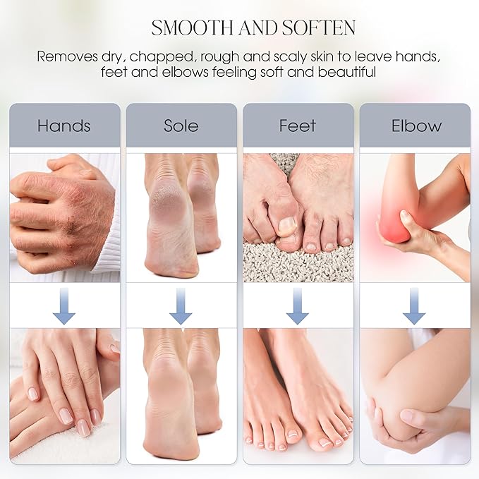 Achzzy Paraffin Wax Machine for Hands and Feet, 4000ml Paraffin Bath, Paraffin Wax Warmer with Refills, Nourishing and Moisturizing, Professional-Grade Spa Treatment for Soft and Smooth Skin