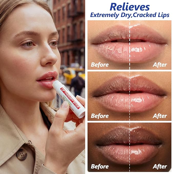 Dmsky Lip Therapy Lip Balm Stick,10 Natural Berry Flavor Healing Hydrating Chapstick Bulk for Chapped Lips Severe,Dry Lips,0.15 OZ