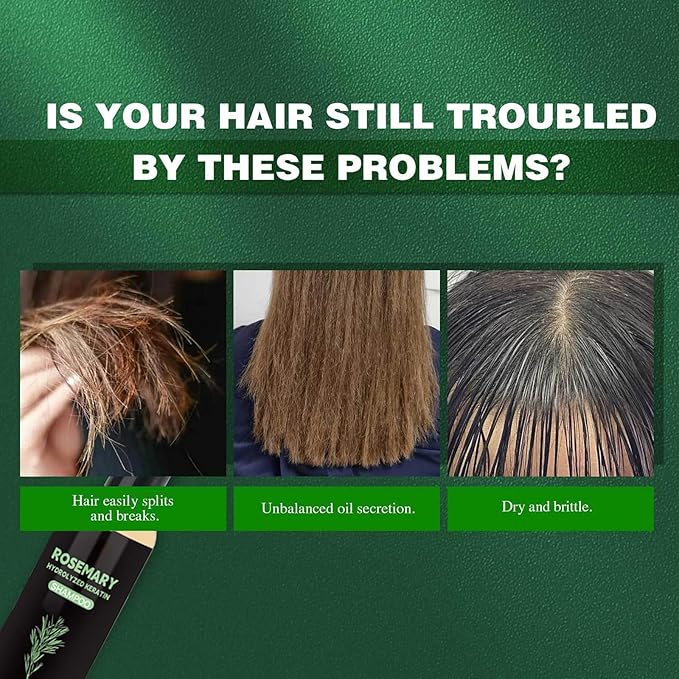 Rosemary Hair Growth Shampoo, Rosemary Hydrolyzed Keratin Shampoo for Thinning Hair – Strengthening & Volumizing Formula – Promotes Thicker Hair for Men & Women – Repairs Damaged – 200ml