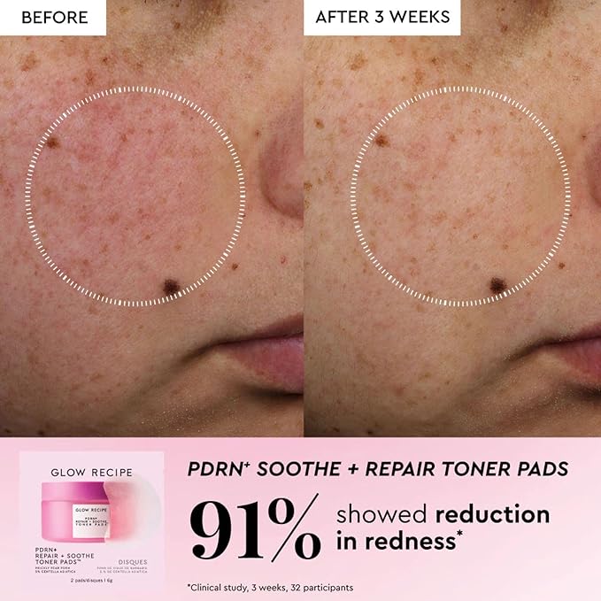 Glow Recipe Toner Pads Kit Trial Set, 12-Piece Korean Toner Pad Kit with Exfoliating, Soothing & Brightening Pads, Fragrance-Free 5-Minute Facial Treatment for Sensitive Skin