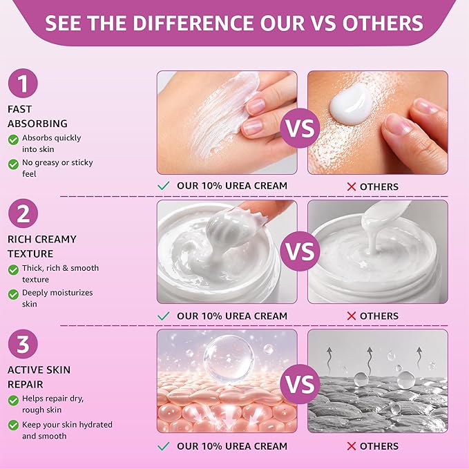 10% Urea Cream with Aloe Vera, Jojoba Oil and Salicylic Acid - 150ml Hydrating Moisturizer for Dry, Chapped Hands, Feet, Face & Body - Repairs, Soothes & Nourishes Rough, Dry Skin - 4 Oz