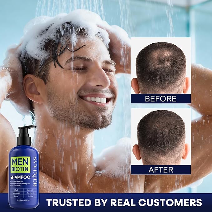 Svvimer Biotin Hair Growth Shampoo - Root Activator Thickening Shampoo for Men - With Rosemary Tea Tree Oil Caffeine For Hair Loss And Thinning Thickening - 13.5 Fl Oz