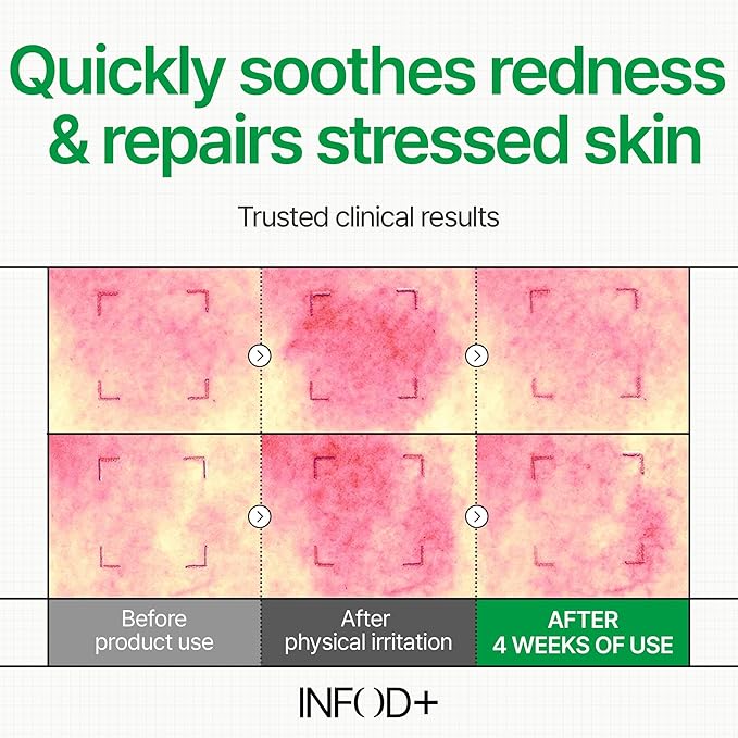 INFODPLUS Sensitive Skin Moisturizer Face Cream with Ceramide and Panthenol, Barrier Repair Support Hydrating Soothing Cream, Lightweight Calming Facial Moisturizer, Korean Skincare 1.69 fl oz, 50ml