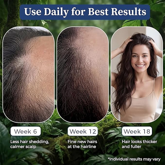 Hair Growth Serum with Rosemary & Saw Palmetto - 0.84 fl oz Roll-On for Visible Hair Thickening & Volume Enhancement - Lightweight, Non-Greasy Formula for Women and Men