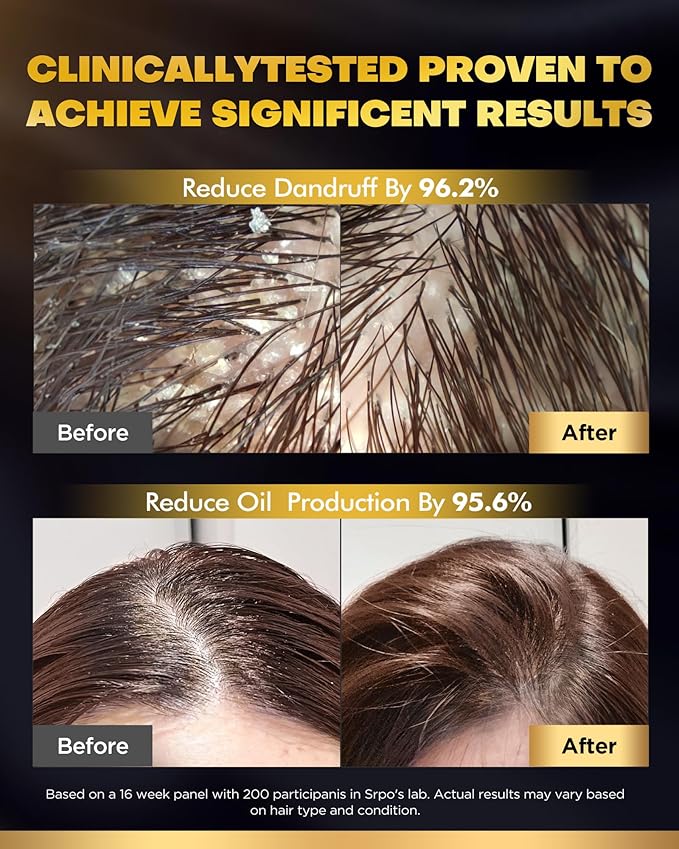 Tripeptide-Infused Biotin Hair Growth Shampoo and Conditioner Set, Onion Anti-Loss Volumizing Moisturizing Treatment for Soft Shine Hair, Dandruff Routine Shampoo for Men and Women, 2x16.9oz