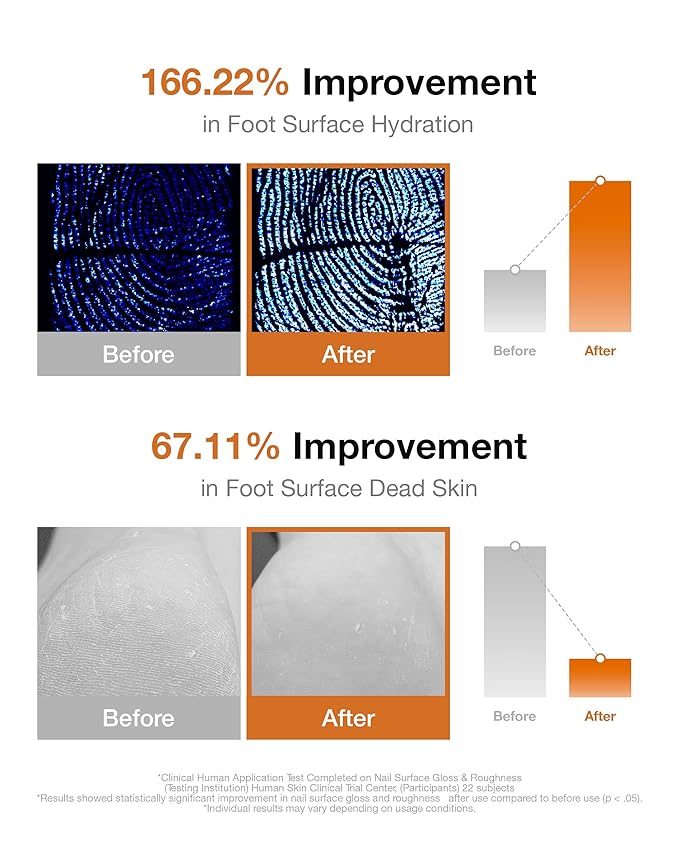 Curoheal Foot Repair Cream – Intensive Moisturizer for Dry, Cracked Heels & Calluses – Concentrated Balm Formula with Shea Butter, Petrolatum, and Patented Magnolia Extract