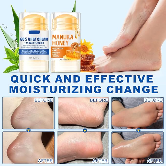 NovaCharm Urea Cream Stick 60%, 2PCS Aloe Vera & Honey Cracked Heel Repair Stick Balm, Maximum Strength Urea Cream for Feet, Foot Lotion for Dry Hands & Rough Knees, Callus Remover - Smoothing Skin