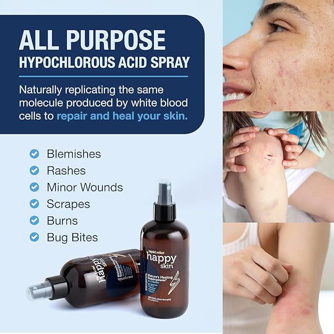 Happy Skin Hypochlorous Acid Spray for Face – Extra Strength, Gentle Hypochlorous Acid Spray Cleanser for Acne – Soothe, Hydrate & Repair Dry, Sensitive Skin – pH Balanced, Non-Toxic 4oz