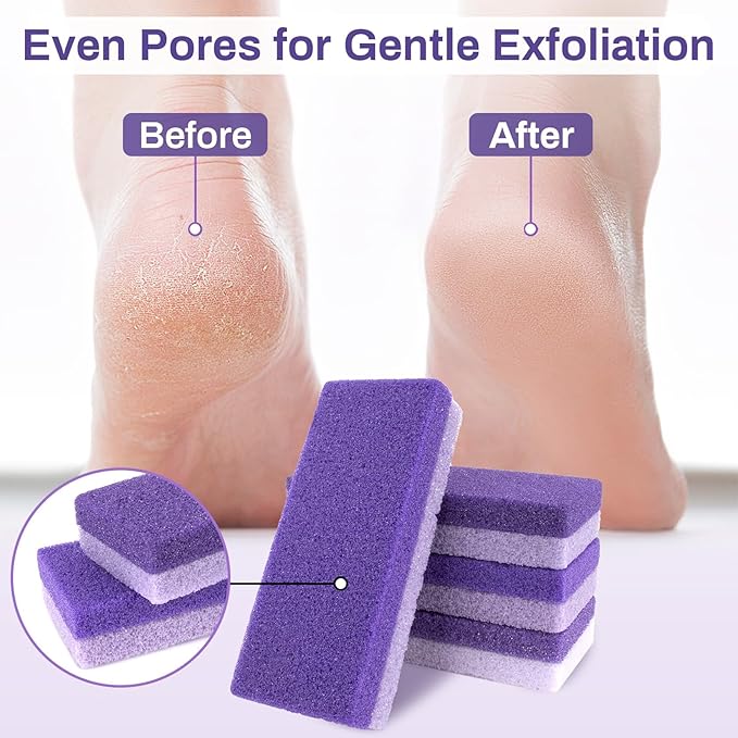 10 Pumice Stone for Feet - 4.7 x 2 x 1 Inch Double Side Purple Foot Pumice Stone, Foot Filer Pedicura Scrubber for Callus Removal, Foot Care Spa Productos for Dark Elbows Hard Skin Exfoliating