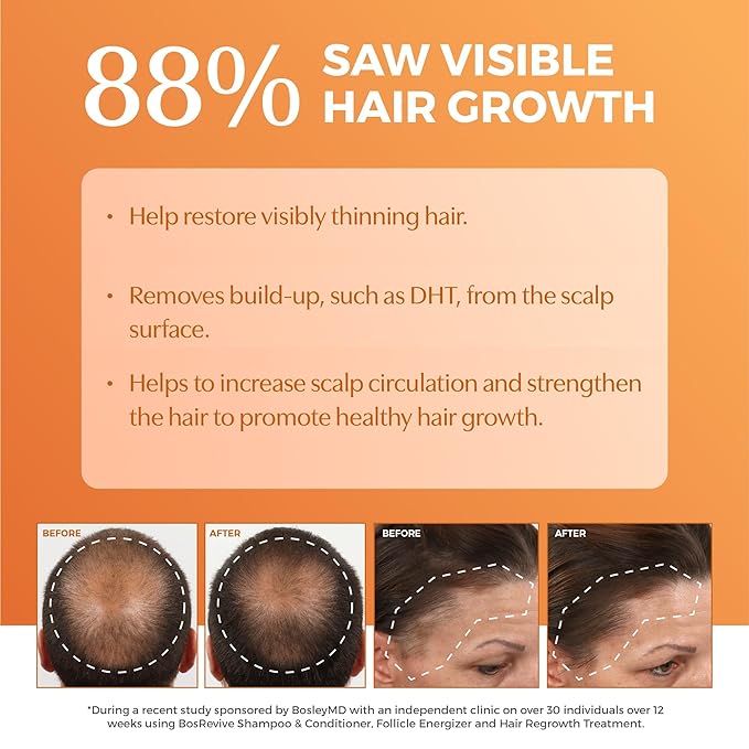 BosRevive Volumizing Conditioner for Thinning, Color/Chemically-Treated Hair – DHT Blocker, Sulfate-Free, Vegan, Biotin, Saw Palmetto & Rosemary – Thicker, Fuller Hair – 10.1 Fl Oz