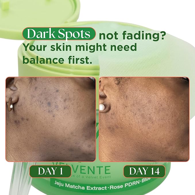 Matcha Facial Moisturizer with Rose PDRN, Korean Peptides Hydrating Firming Cream for Anti Aging, Dark Spot & Uneven Skin Tone, Soothing Radiance for Soft, Glowy Skin, All Skin Types, 3.53 oz
