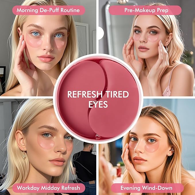 Under Eyes Patches, 40 Pairs Rose Hydrogel Eye Mask for Puffy Eyes and Dark Circles with Rose Essence, Hyaluronic Acid & Niacinamide, Deep Hydrating Eye Treatment for Men & Women
