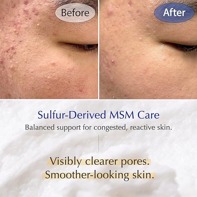 MSM Sulfur Deep Pore Cleanser – Low pH Barrier-Respecting Face Wash, Pore Reset for Sensitive Skin