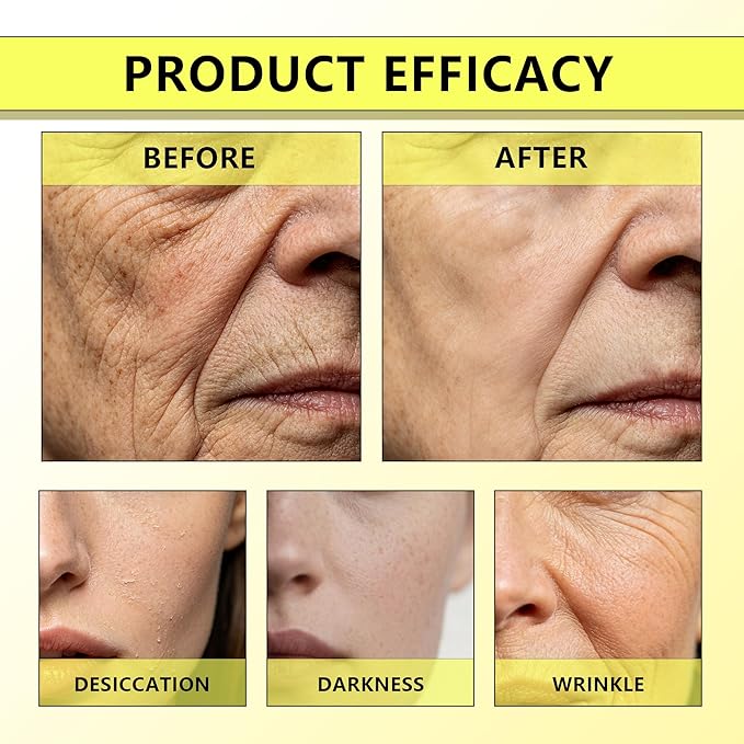 Botoxmix & Vita A Retinal Shot Tightening Booster | Wrinkle-Lift Tightening Cream, Collagen Lifting Serum, Retinoid for Anti-Aging, Pore Minimizer, Wrinkles & Fine Lines, Firmer Skin (15ml x 2 PCS)