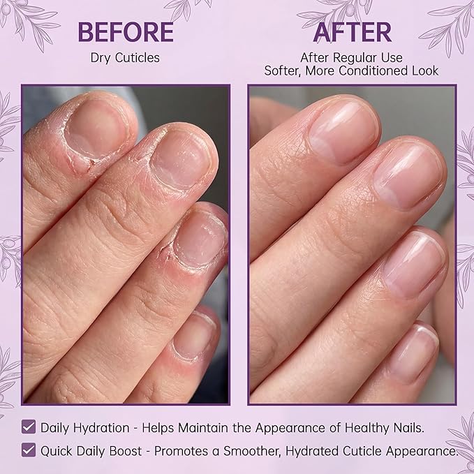Cuticle Oil Pen for Dry Cracked Cuticles - Hydrating Nail Moisturizer with Jojoba Oil, Vitamin E, Tea Tree & Squalane, Portable Brush Pen for Nails - 15ml Each (Pack of 2)
