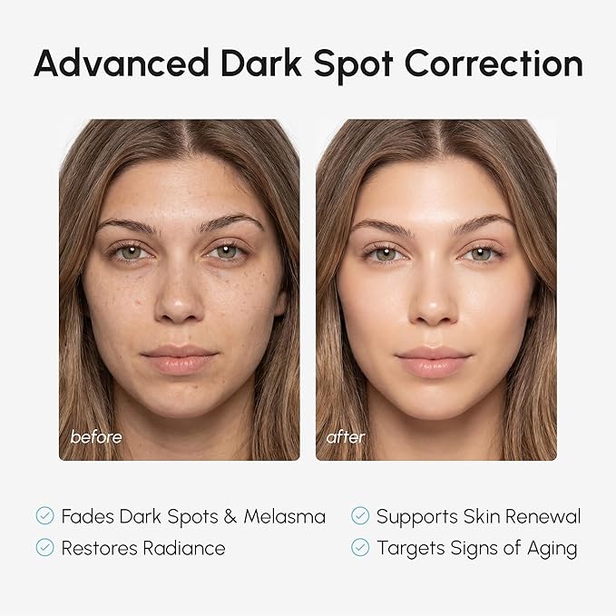 MAREE Tranexamic Acid & Alpha Arbutin Cream - Face Cream with Niacinamide, Hyaluronic & Azelaic Acid - Crema para Manchas Oscuras en la Cara