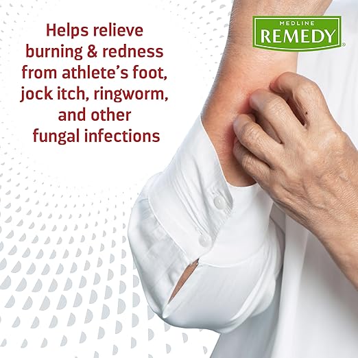 Medline Remedy Clinical Antifungal Ointment, 2.5 oz., Effective Treatment for Athlete's Foot & Ringworm, Single Tube