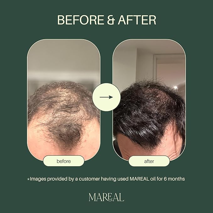 Pure Rosemary Oil for Hair Growth & Scalp Health | Infused with Castor & Coconut Oil | Hair Thickening & Regrowth Treatment for Women & Men | 100% Natural | Up to 2-Month Supply | 1.7 fl oz