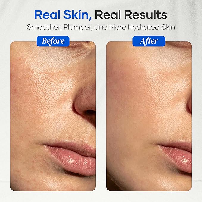 DERMAdoctor Dermatologist Formulated Skincare Set – Cleansing Oil, Hyaluronic Acid & Niacinamide Serum, Bakuchiol Anti Aging Serum, Vitamin C Ceramide Barrier Moisturizer for Sensitive Skin