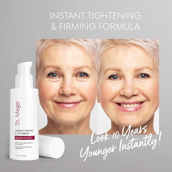 Instant Eye & Face Lift Cream: Rapid Under Eye Bags Wrinkle Smile Lines Forehead Lines Remover - Temporary Firming & Tightening Treatment in 2 Minutes, 1 fl. oz.