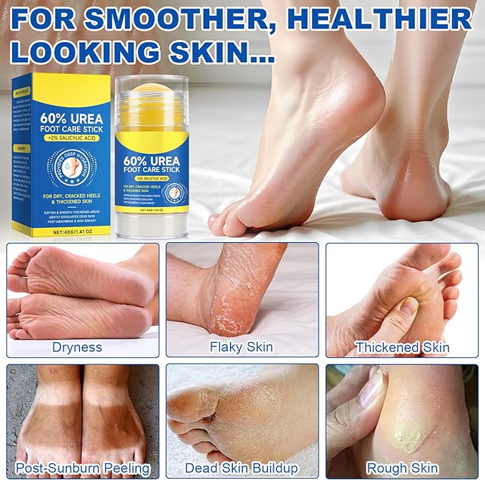 2Pcs 60% Urea with 2% Salicylic Acid Urea Foot Care Stick, Foot Cream 60 Percent for Feet Maximum Strength Moisturizer for Dry Cracked Heels,Hands,Cracked Skin, Callus Remover Repair, Deep Hydration