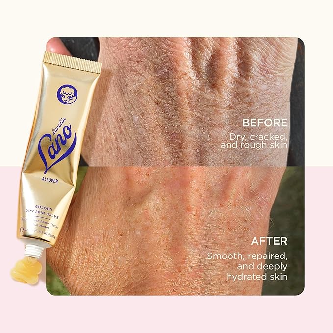 Lanolips Golden Dry Skin Salve - Lanolin Oil Healing Ointment with Vitamin E & Manuka Honey - Body Moisturizer for Dry Skin - Relief for Dry Hands & Cracked Lips - Dermatologist Tested (25g)