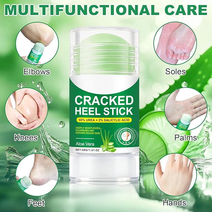60% Urea Aloe Foot Cream Maximum Strength for Cracked Heels and Dry Skin, Deep Moisturizing Urea Cream, Foot Stick Cracked Heel Repair Cream, Repairing Creams for Heels, Knees, Elbows & Hands 1.41 oz