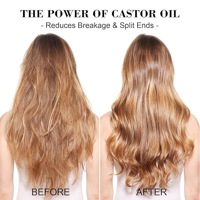 2 Pack Castor Oil Shampoo Bars for Hair Growth & Thickening - pH Balanced & Sulfate Free Solid Shampoo Duo for Breakage-Prone Hair - Scalp Cleanse & Frizz Control