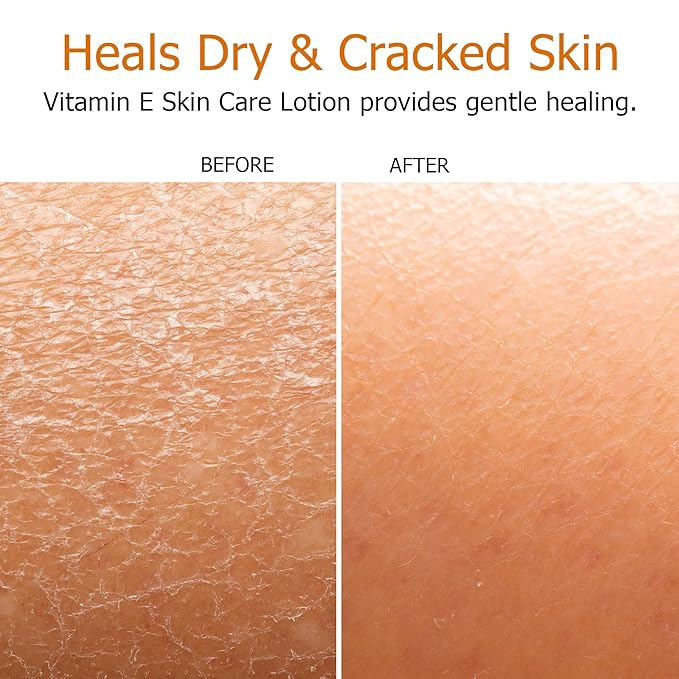 Fruit of the Earth, Vitamin E Lotion, 16 oz