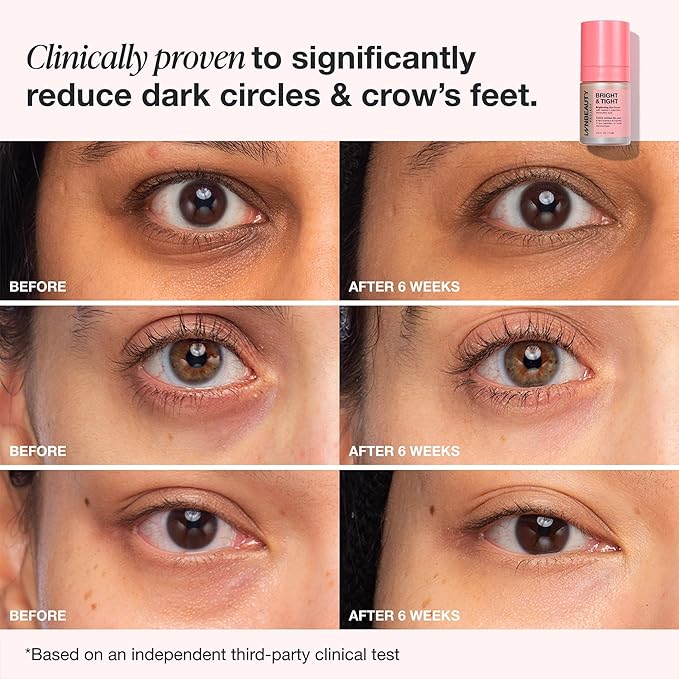 Innbeauty Project Bright & Tight Eye Cream with Vitamin C & Peptides for Dark Circles & Firming, 0.5 OZ (15ml)