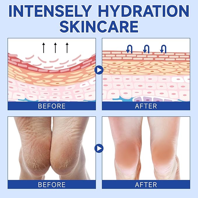 Urea Cream 60 Percent For Feet Maximum Strength - Intensive Repair Dry Cracked Skin, Urea Cream For Feet, Foot Cream For Dry Cracked Heels, 1 Pcs - 1.41 Oz