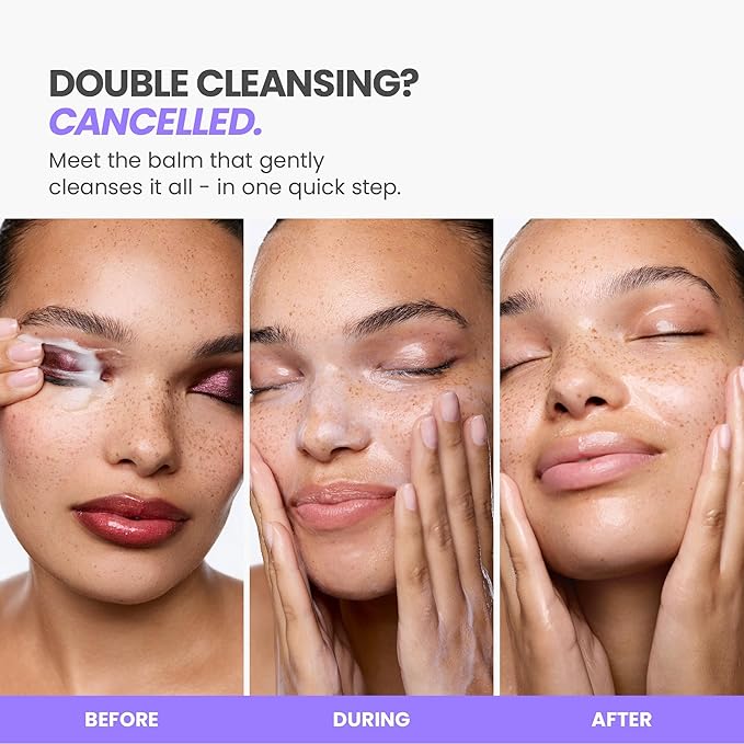 Wonderskin Cleansing Balm Refill Pod – Balm to Milk Makeup Remover, Melt-It-All Gentle Hydrating Face Cleanser with Centella and Chamomile