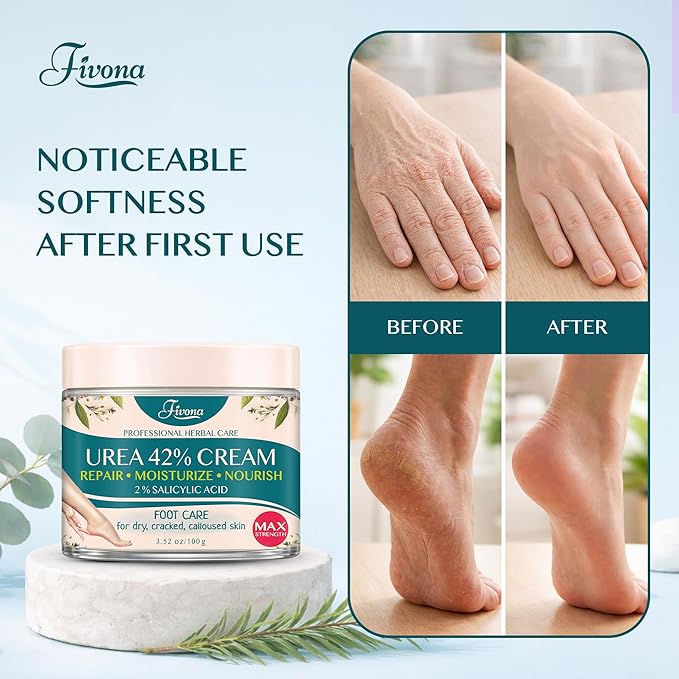 FIVONA 42% Urea Foot Cream for Thick, Rough Dry Skin - Maximum Strength Callus Softening with 2% Salicylic Acid, Tea Tree & Aloe Vera, 100g (3.5 oz) - Deep Moisturizing Foot Care