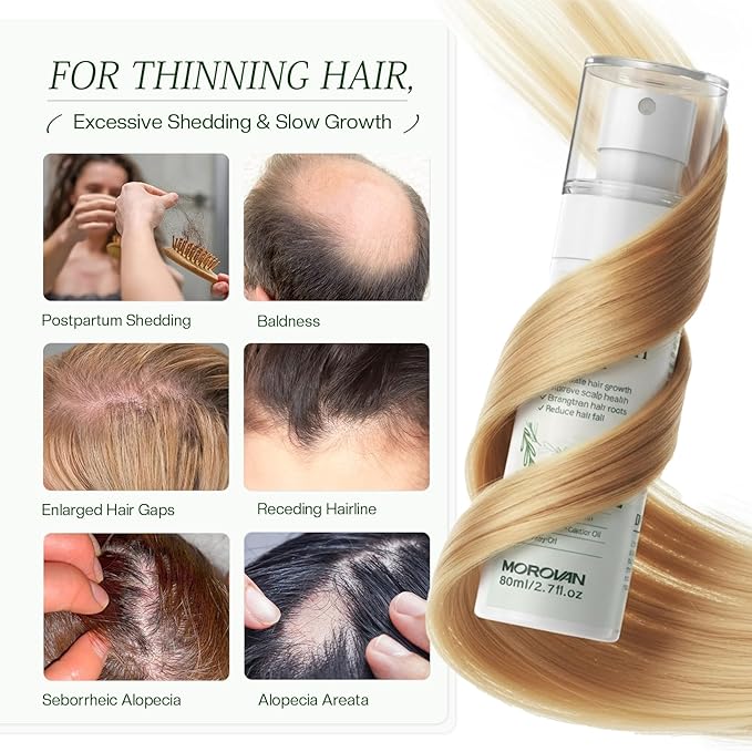 Morovan Hair Growth Spray for Scalp: 30 Days Hair Loss Reduction & Hair Growth with Batana and Castor Oil for Thinning Hair & Damaged Hair & Severe Hair Loss-2.7 fl oz
