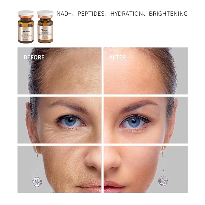 NAD+ Anti-Aging Peptides Serum – Fresh Activation, NAD+ & Collagen Peptides for Wrinkle Repair & Firming, Hydration & Brightening Without Microneedling, 20-days Supply for All Skin Types